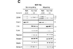 Western Blotting (WB) image for anti-Radixin (RDX) antibody (ABIN2856100)