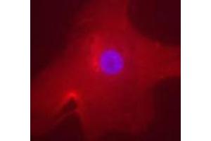 Immunofluorescent staining of MLXIPL in human hepatocyte using MLXIPL polyclonal antibody . (MLXIPL 抗体  (AA 800-852))