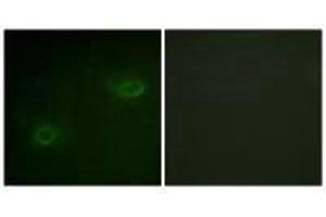 Immunofluorescence analysis of HeLa cells, using Syndecan4 (Ab-179) antibody. (SDC4 抗体  (Ser179))