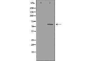 Western blot analysis of extracts of CEM, using CYP1B1 antibody. (CYP1B1 抗体  (Internal Region))