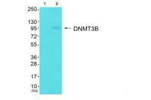 Western blot analysis of extracts from HuvEc cells (Lane 2), using DNMT3B antiobdy. (DNMT3B 抗体  (N-Term))