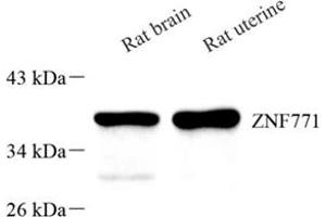 Western blot analysis of Znf771 (ABIN7076273)at dilution of 1: 500 (ZNF771 抗体)