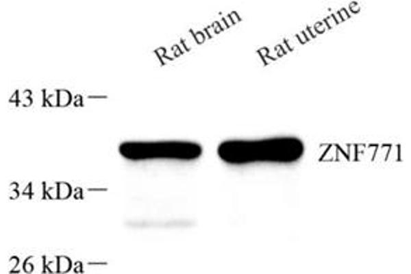 ZNF771 抗体