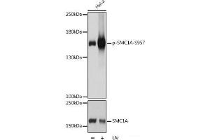 Western blot analysis of extracts of HeLa cells using Phospho-SMC1A(S957) Polyclonal Antibody at dilution of 1:1000. (SMC1A 抗体  (pSer957))