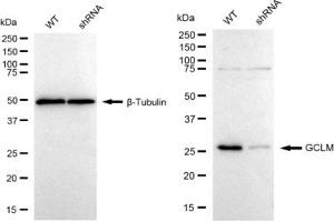 Western blotting analysis using GCLM antibody (ABIN7798743). (Recombinant GCLM 抗体)