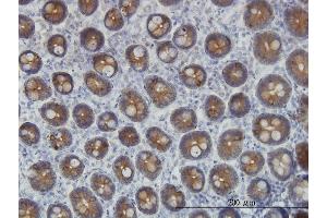 Immunoperoxidase of monoclonal antibody to KRT4 on formalin-fixed paraffin-embedded human small Intestine. (KRT4 抗体  (AA 194-300))