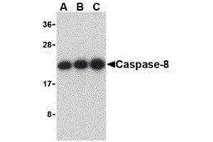 Western Blotting (WB) image for anti-Caspase 8 (CASP8) (C-Term) antibody (ABIN2477922) (Caspase 8 抗体  (C-Term))