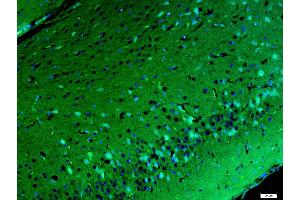 Immunofluorescence (Paraffin-embedded Sections) (IF (p)) image for anti-Adaptor-Related Protein Complex 1, gamma 1 Subunit (AP1G1) (AA 721-822) antibody (ABIN731873)