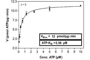 Image no. 2 for Homeodomain Interacting Protein Kinase 3 (HIPK3) (AA 163-562) (Active) protein (ABIN5569812)