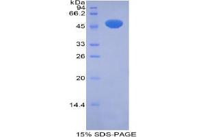 SDS-PAGE analysis of Rat Pregnane X Receptor Protein. (NR1I2 蛋白)