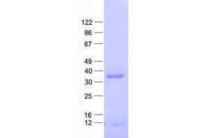 Validation with Western Blot