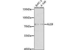 Western blot analysis of extracts of various cell lines, using  antibody (ABIN7265697) at 1:1000 dilution. (ALG9 抗体  (AA 439-618))