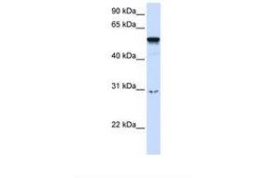 Image no. 1 for anti-Autoimmune Regulator (AIRE) (AA 218-267) antibody (ABIN6737664) (AIRE 抗体  (AA 218-267))