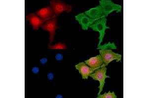 ABIN7095862 and ABIN7099924 staining HepG2 cells by IF/ICC. (RBM7 抗体)