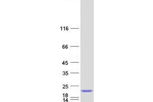 Western Blotting (WB) image for Gem (Nuclear Organelle) Associated Protein 6 (GEMIN6) protein (Myc-DYKDDDDK Tag) (ABIN2721791)