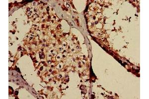 Immunohistochemistry of paraffin-embedded human testis tissue using ABIN7171472 at dilution of 1:100 (TAF6L 抗体  (AA 345-433))
