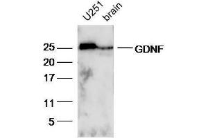Lane 1:U251 lysates and Lane 2: Mouse brain lysates probed with Rabbit Anti-GDNF Polyclonal Antibody, Unconjugated  at 1:5000 for 90 min at 37˚C. (GDNF 抗体  (AA 121-211))