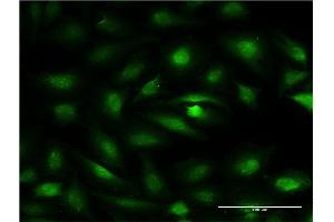 Immunofluorescence of monoclonal antibody to ZBTB7A on HeLa cell. (ZBTB7A 抗体  (AA 1-108))