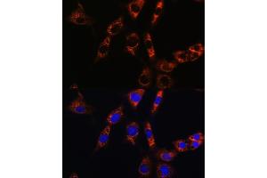 Immunofluorescence analysis of NIH/3T3 cells using  Rabbit pAb (ABIN6133587, ABIN6137053, ABIN6137054 and ABIN6224632) at dilution of 1:100. (Aquaporin 8 抗体  (AA 50-150))