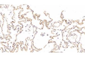 Detection of ICAM1 in Human Lung Tissue using Monoclonal Antibody to Intercellular Adhesion Molecule 1 (ICAM1)