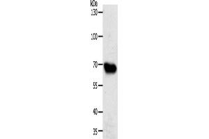 Western Blotting (WB) image for anti-ATP-Binding Cassette, Sub-Family G (WHITE), Member 1 (ABCG1) antibody (ABIN2426499) (ABCG1 抗体)