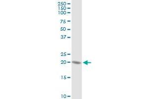 HSPC111 MaxPab rabbit polyclonal antibody. (NOP16 抗体  (AA 1-178))