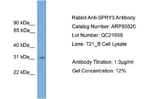 WB Suggested Anti-SPRY3  Antibody Titration: 0. (SPRY3 抗体  (N-Term))