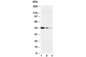 Western blot testing of Caspase-1 antibody and Lane 1:  Jurkat (Caspase 1 抗体  (Large Subunit, N-Term))