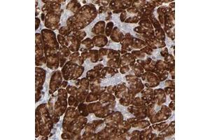 Immunohistochemical staining of human pancreas with FANCB polyclonal antibody  shows strong cytoplasmic positivity in exocrine glandular cells. (FANCB 抗体)