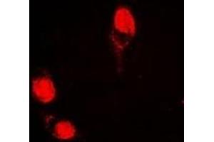Immunofluorescent analysis of AGFG1 staining in HepG2 cells. (AGFG1 抗体)