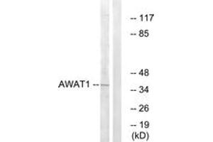 Western blot analysis of extracts from 293 cells, using AWAT1 Antibody. (AWAT1 抗体  (AA 261-310))