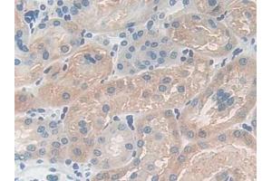 Detection of CPB1 in Mouse Kidney Tissue using Polyclonal Antibody to Carboxypeptidase B1, Tissue (CPB1) (CPB1 抗体  (AA 109-415))