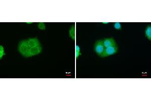 ICC/IF Image StAR antibody detects StAR protein at mitochondria by immunofluorescent analysis.