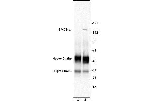 SMC1- a antibody (pAb) tested by Immunoprecipitation. (SMC1A 抗体  (C-Term))