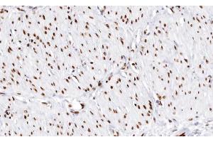 Immunohistochemistry (IHC) image for anti-Distal-Less Homeobox 3 (DLX3) (Internal Region) antibody (ABIN6261315)