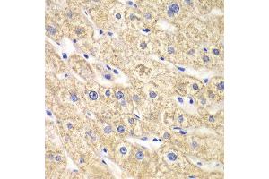 Immunohistochemistry of paraffin-embedded human liver injury using ACADS antibody at dilution of 1:100 (x40 lens). (ACADS 抗体)