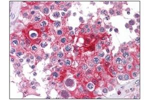 Immunohistochemistry (IHC) image for anti-Lactate Dehydrogenase A (LDHA) antibody (ABIN614512) (Lactate Dehydrogenase A 抗体)