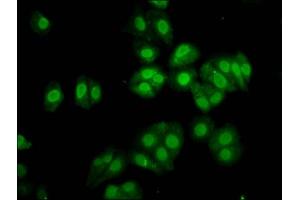 Immunofluorescence staining of HepG2 cells with ABIN7172627 at 1:133, counter-stained with DAPI. (SOX3 抗体  (AA 84-206))