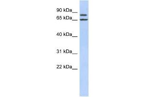 WB Suggested Anti-FSIP1 Antibody Titration: 0. (FSIP1 抗体  (Middle Region))