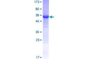 Myo-Inositol Oxygenase (MIOX) (AA 1-285) protein (GST tag)