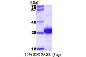SDS-PAGE (SDS) image for Myosin, Light Chain 6B, Alkali, Smooth Muscle and Non-Muscle (MYL6B) (AA 1-208) protein (His tag) (ABIN667554)