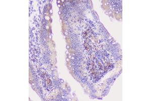 IHC analysis of CFP using anti-CFP antibody (ABIN6719298).