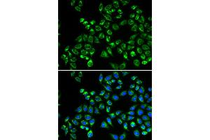 Immunofluorescence analysis of HeLa cells using C1QBP antibody. (C1QBP 抗体)