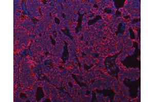 IF analysis of ATP5F1B using anti-ATP5F1B antibody (ABIN7599866). (Atp5f1b (AA 123-529) 抗体)