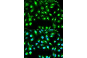 Immunofluorescence analysis of A549 cells using GEMIN2 antibody. (SIP1 抗体)