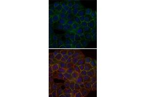 Immunofluorescence analysis of HepG2 cells using BLNK monoclonal antibody, clone 5G9  (green). (B-Cell Linker 抗体)