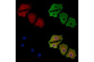 ABIN6258194 and ABIN6273898 staining Hela cells by IF/ICC. (GPR83 抗体  (N-Term))