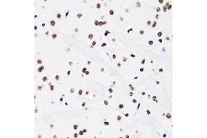 Immunohistochemistry of paraffin-embedded mouse brain using H3K18ac antibody (ABIN7267668) at dilution of 1:100 (40x lens).