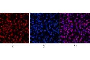 Immunofluorescence analysis of human lung cancer tissue.