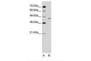 Image no. 1 for anti-LRP2 Binding Protein (LRP2BP) (AA 151-200) antibody (ABIN6736640) (LRP2BP 抗体  (AA 151-200))